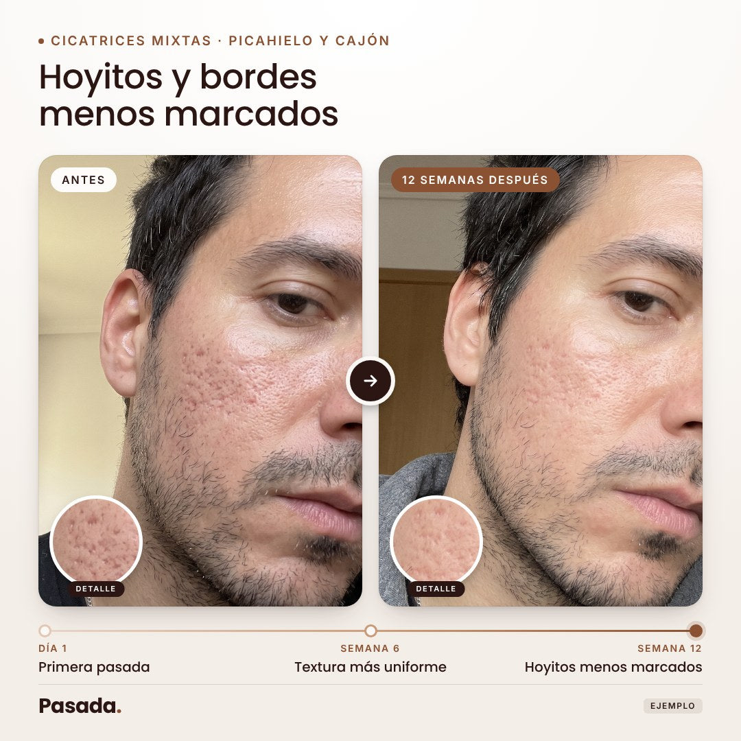 Cómo se usa (3 pasos)
