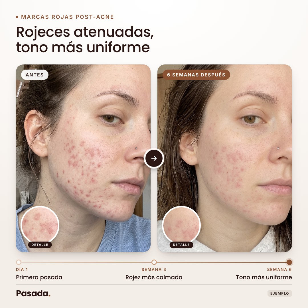 Garantía / qué incluye